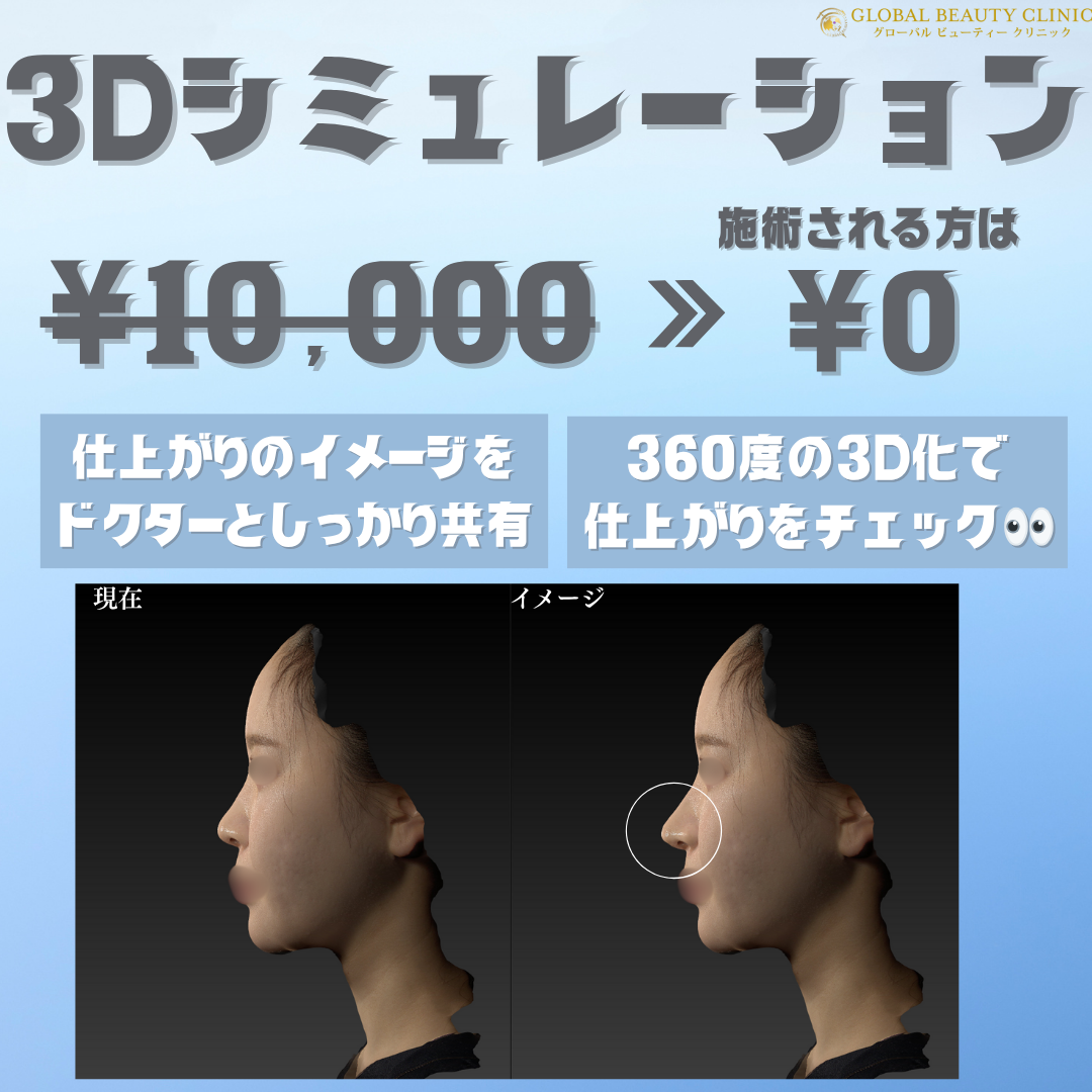 3Dシミュレーショングローバルビューティークリニック