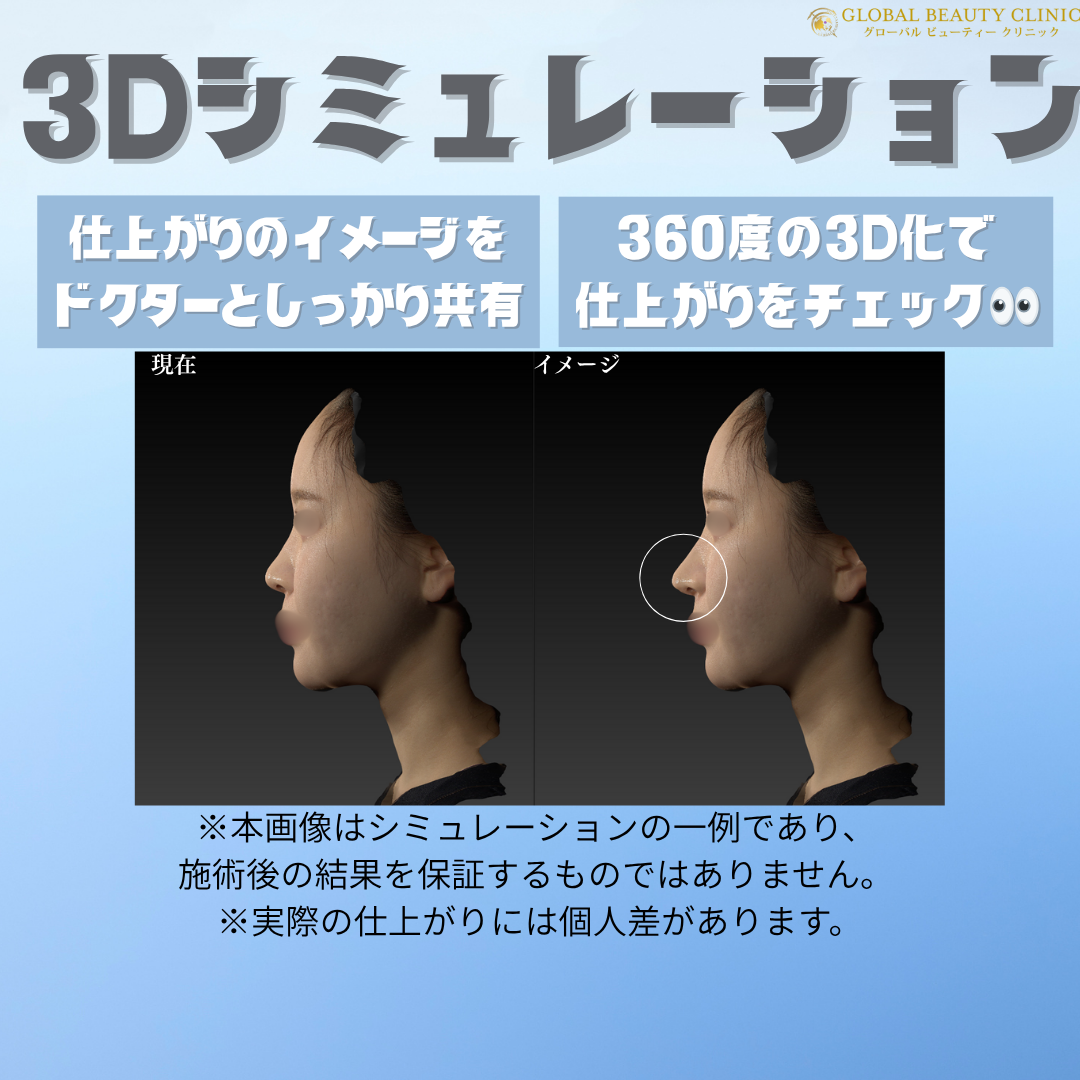 3Dシミュレーショングローバルビューティークリニック