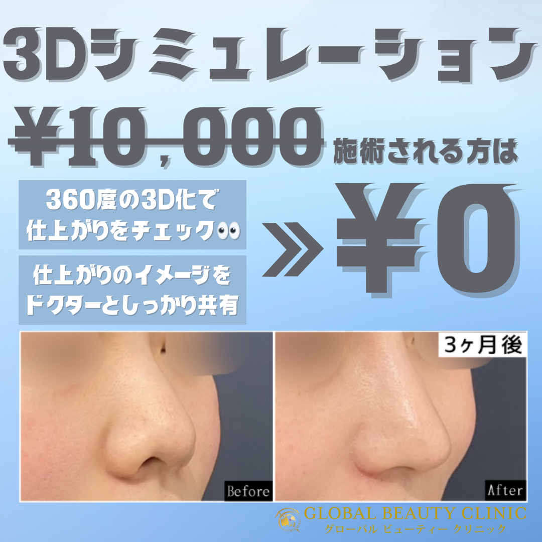 eyecatch image
