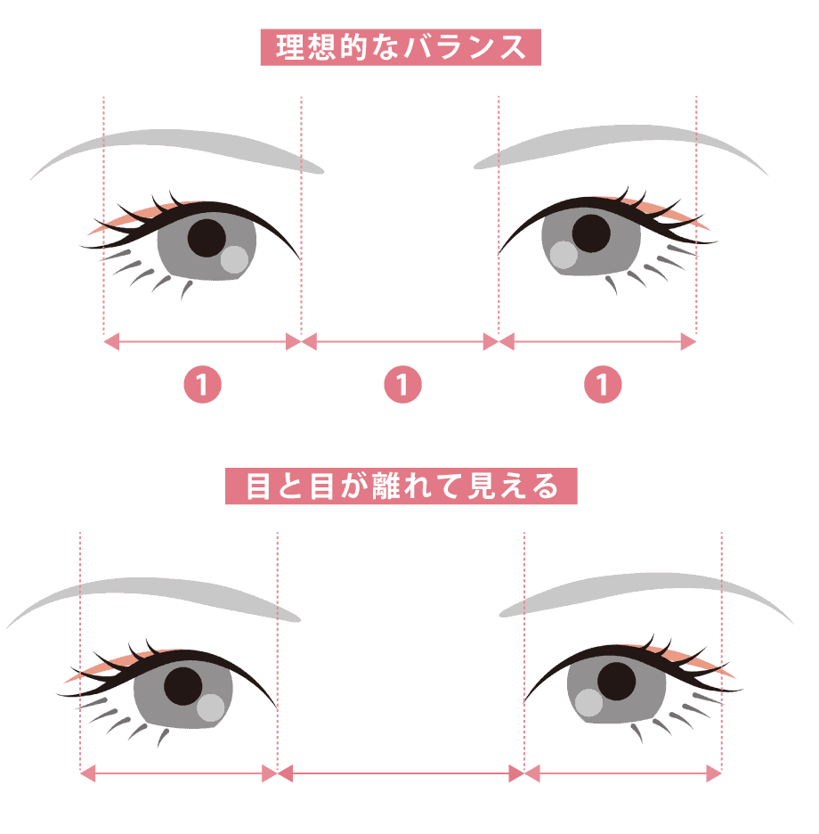 目頭切開の構図