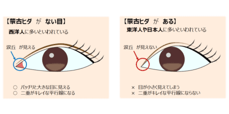 美鼻を手に入れ 生活が変わった人たち 症例 鼻整形なら大阪のグローバルビューティークリニック