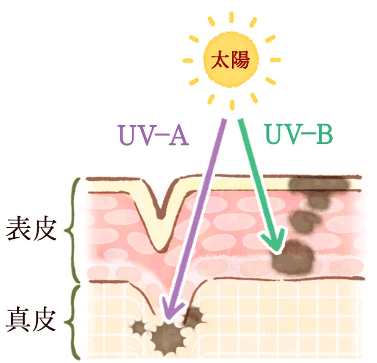 図1　紫外線により肌がダメージを受ける