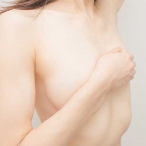 乳房つり上げイメージのモニター施術