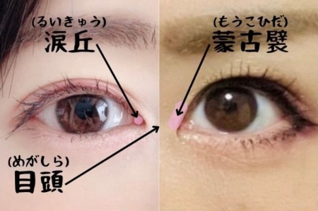 蒙古襞が与える印象とは？目頭切開がおすすめのケースや手術の注意点を