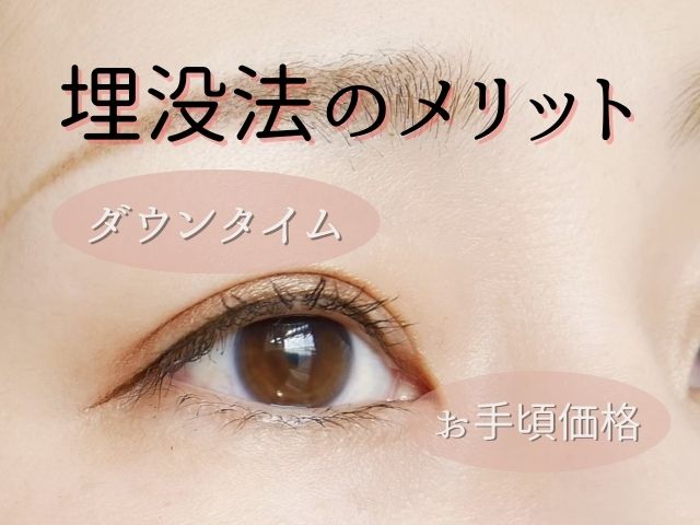 二重まぶたにするなら?「二重手術埋没法」を選択するメリット
