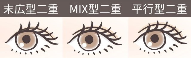 今流行っている二重デザインはMIX型？二重デザインをすべてご紹介します！